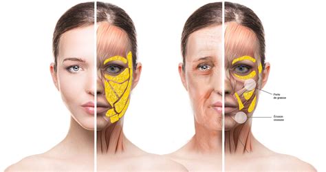 You can take any video, trim the best part, combine with other videos, add soundtrack. Injections d'acide hyaluronique à Lyon par le Dr Vertu-Ciolino