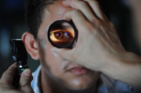Gejala awal blefarospasme adalah kelopak mata yang sering berkedip, kemudian menutup dan tak bisa terbuka. Arti Kedutan Mata Kanan Atas dan Bawah Dalam Mitologi Jawa