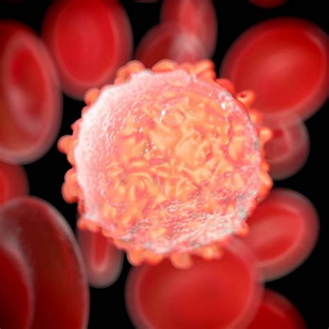 14 Unknown Signs And Symptoms Of Blood Cancer