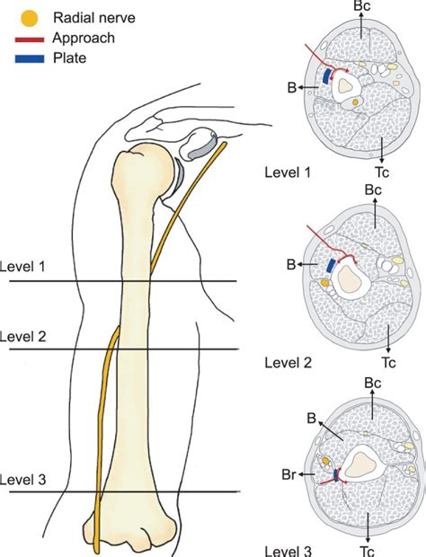 Cross section of bone diagram. Cross-sectional anatomy of the distal humeral shaft. Cross ...