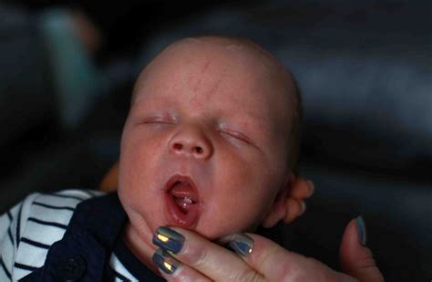 Baby Born With Fully Formed Tooth Metro News