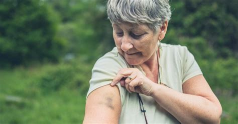 Hep C Symptoms | Signs of Hep C Flare Up Implications for the physical therapist.