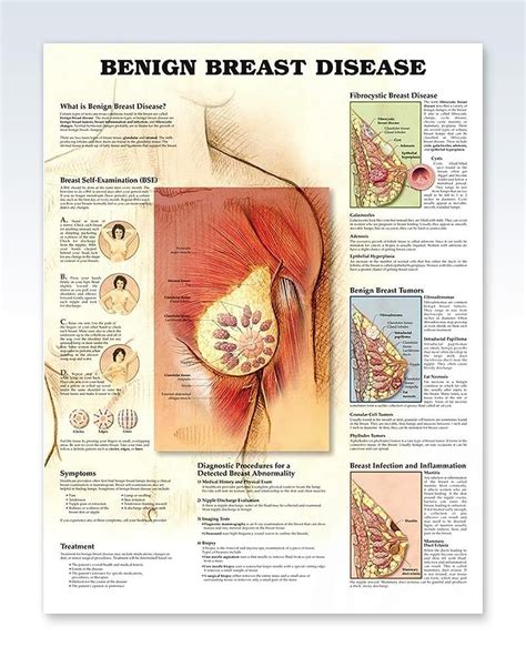 Dermatomes Anatomy Poster Defines Dermatomes And Illustrates Cutaneous