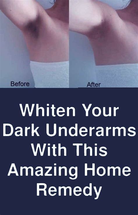 Pin On How To Detox Your Armpits