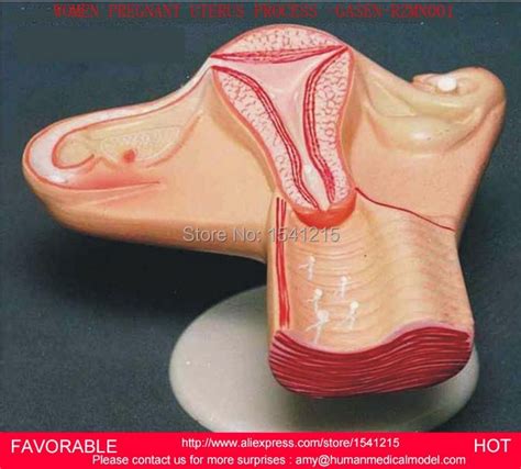 The Pathological Model Of The Uterus Uterine Anatomy Genital Organ My
