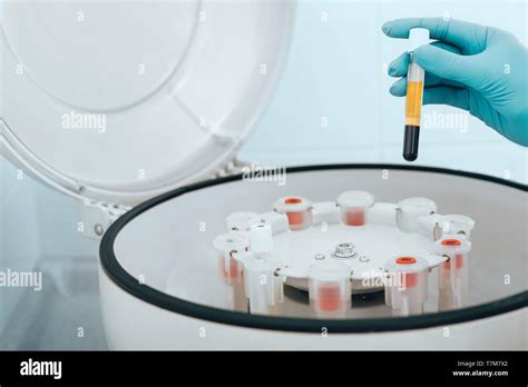 Hematology Laboratory Technician Hi Res Stock Photography And Images