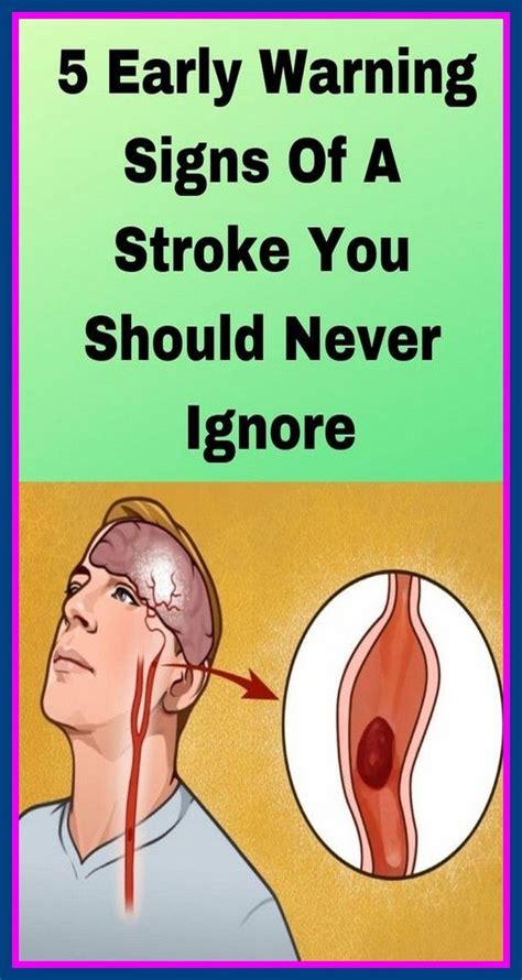 Signs Of Stroke That You Should Never Ignore Fitneess In 2021