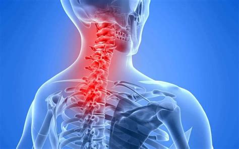 Neck Pain Symptoms Treatments And Solutions Progressive Spine