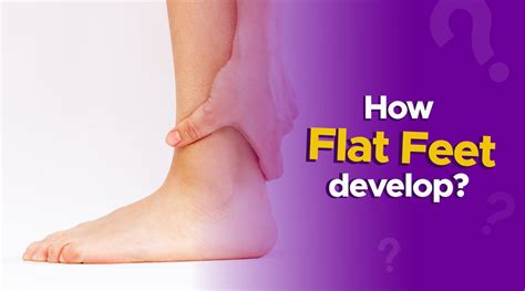 What Are Flat Feet And How Do They Develop Myfrido