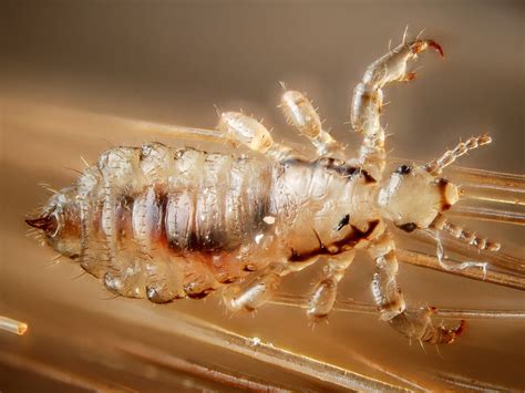 Scour That Scalp Some Lice Eggs Linger Before Hatching Science Aaas