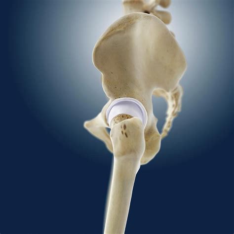 Hip Anatomy Photograph By Springer Medizinscience Photo Library Pixels