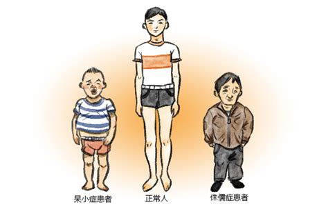 《進擊的巨人》（日语：進撃の巨人）是諫山創的日本漫畫作 see more of 进击的巨人 on facebook. 呆小症和侏儒症的病因有哪些？-科普中国