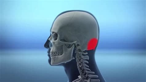 Poor Posture Due To Smartphone Use Leads To Horn Bone Growth In Skull