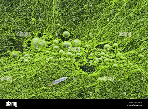 Cyanobacteria Nostoc Under Microscope Micropedia