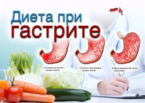 Острый гастрит диеты Острый гастрит рекомендации по лечению и питанию Острый гастрит рекомендации по лечению и питанию Острый гастрит диеты