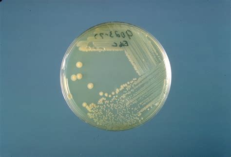 Public Domain Picture This Is A Trypticase Soy Agar Plate Culture Of