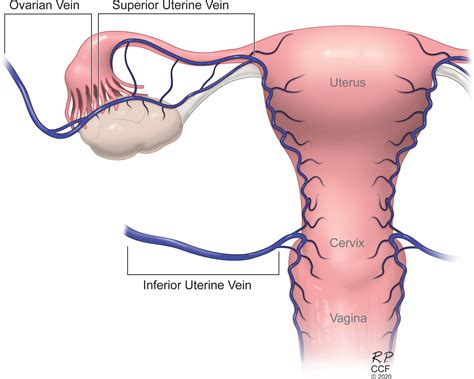 Guidelines For Standardized Nomenclature And Reporting In Uterus Transplantation An Opinion