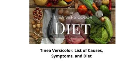 Tinea Versicolor List Of Causes Symptoms And Diet