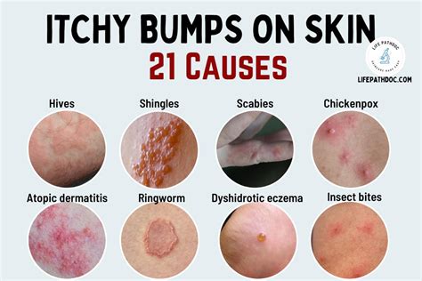 Itchy Bumps On Skin Causes Pictures And Treatment