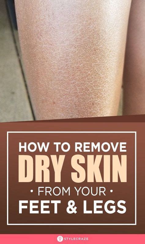 How To Remove Dry Skin From Your Feet And Legs Dry Flaky Skin Dry