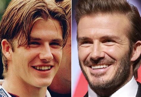 Kamara, hogan, gabriel to catch fire. CELEBS WITH BAD TEETH - HOW FAR DID THEY GO? THEIR DENTAL ...