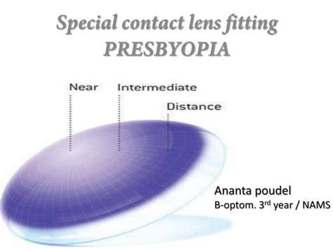 Presbyopia Contact Lens Options Ppt