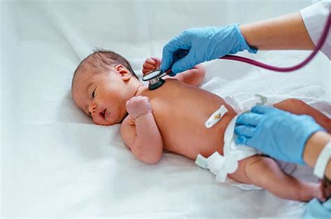 Ini Tes Kesehatan Yang Perlu Dilakukan Bayi Baru Lahir
