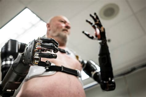 Robotic Human Arm Implantations