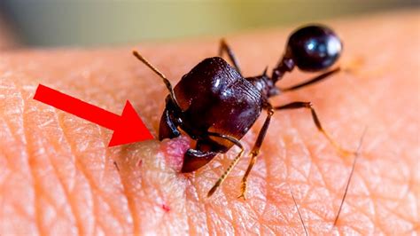 9 Most Dangerous Insects In The World Youtube