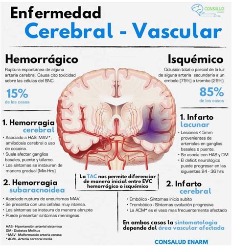 Enfermedad Cerebral Vascular Cosas De Enfermeria Medicina De
