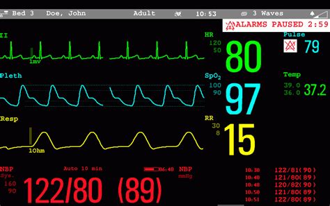 It is not a co2 detector! Greater focus oncontinuous monitoring may be useful