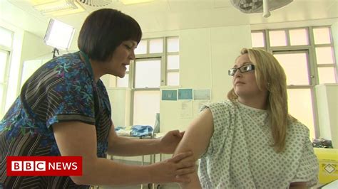 Counting Arm Moles May Predict Risk Of Skin Cancer Bbc News