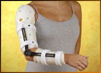 Fracture - Kiser's Orthotics Prosthetics