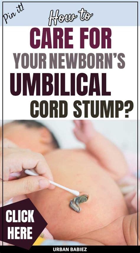 Tips To Take Care Of Your Babys Umbilical Cord