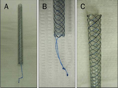A A Photo Of Fully Covered Self Expandable Metal Stent 0 610 Cm