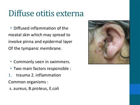 Diseases Of External Ear