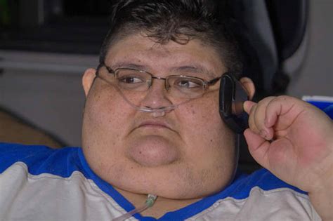 Worlds Fattest Man Juan Pedro Franco Needs Surgery To Lose 79 Stone