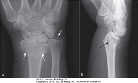 rad test 5 ch 22 at South College - StudyBlue