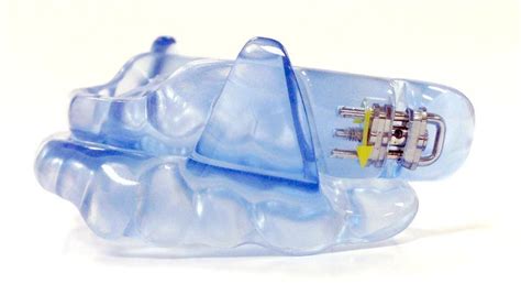 Sleep Apnea Mouthpieces And Devices Advice And Guide American Sleep Assoc
