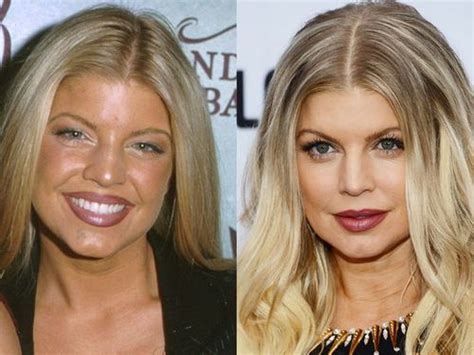 Celebrity Nose Job Before And After Women