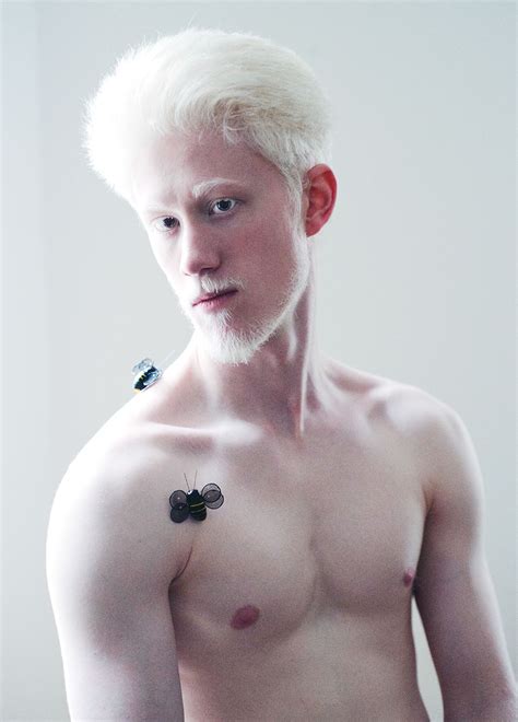 Albino People