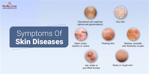 Types Of Skin Diseases And There Side Effects Vedicline