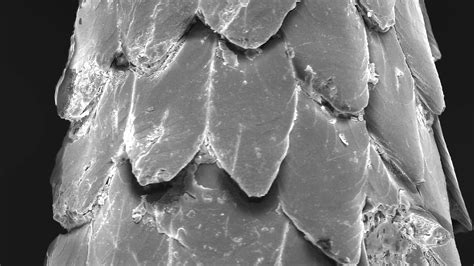 Video Wound Healing Might Be Improved With Staples Modeled On