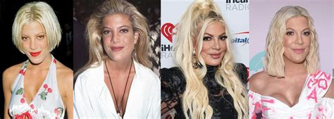 Tori Spelling Plastic Surgery Before And After Pictures