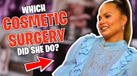 Chrissy Teigen Reveals What Cosmetic Surgery She Did To Her Face Youtube