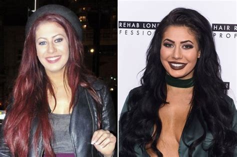 Geordie Shores Chloe Ferry Admits Shes Addicted To Plastic Surgery