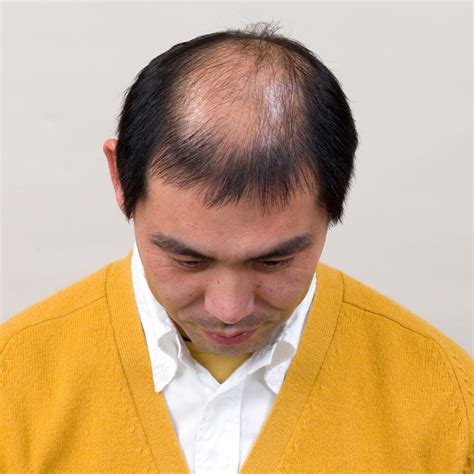 男性用かつらモデル装着例ヘアスタイル集