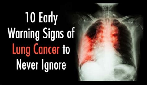 10 Early Warning Signs Of Lung Cancer You Need To Know