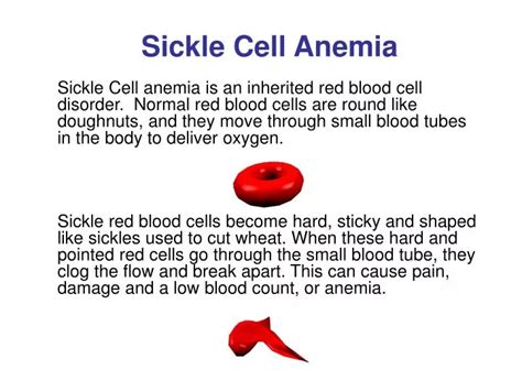 How Common Is Sickle Cell Anemia Png Mohamed E Mendez