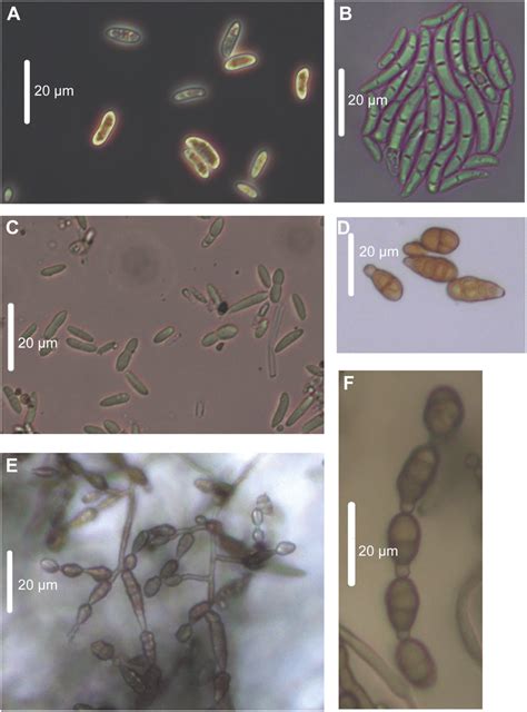 Morphology Of Native Fungal Pathogens Observed By Light Microscopy